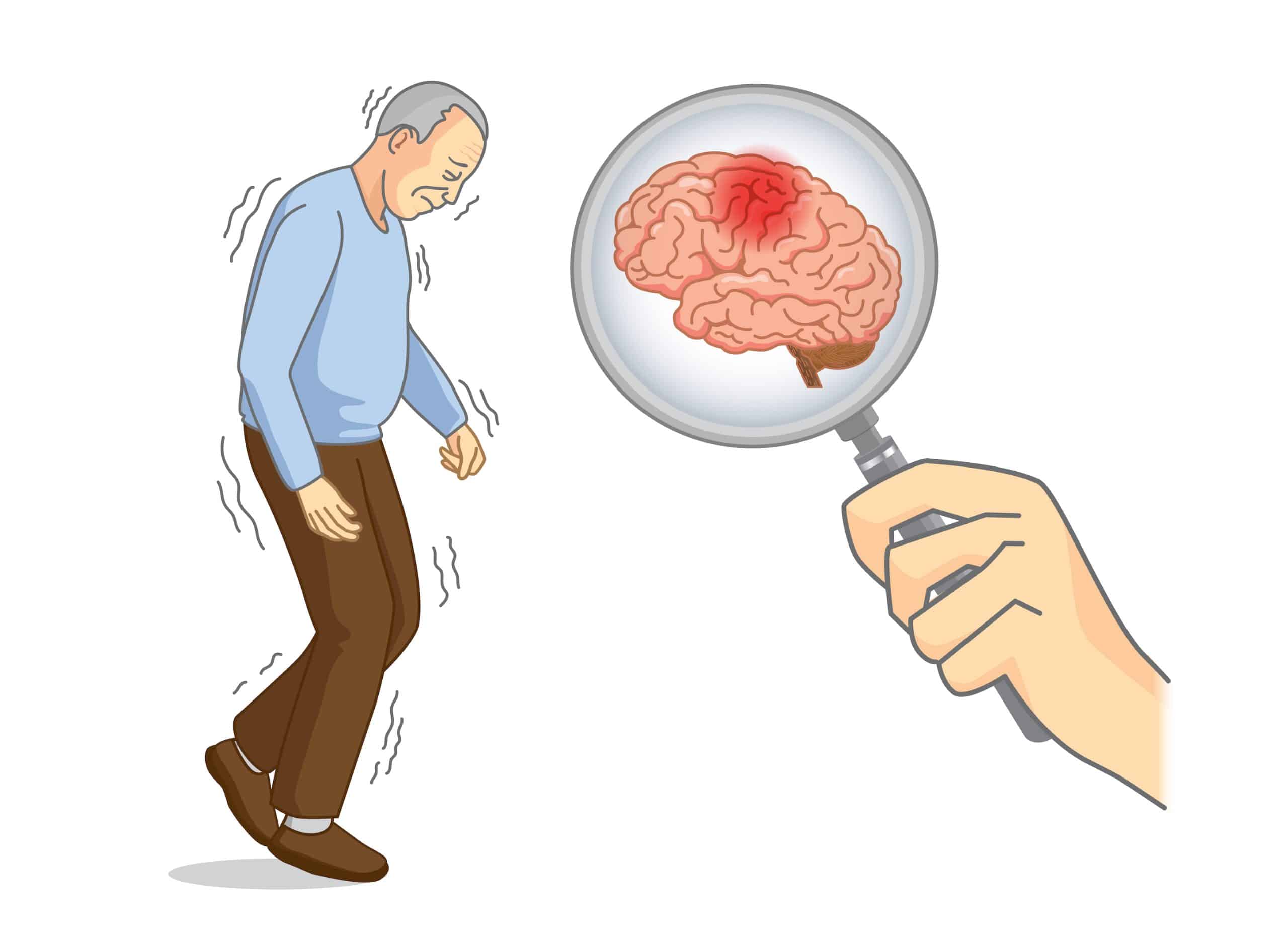 Parkinson's Disease Treatment